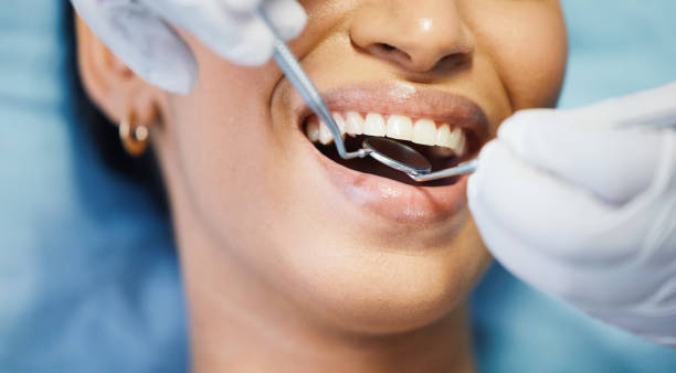 Best Emergency Treatment for Dental Infections or Abscesses in Shelby, OH
